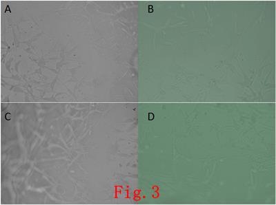 Study on a 3D-Bioprinted Tissue Model of Self-Assembled Nanopeptide Hydrogels Combined With Adipose-Derived Mesenchymal Stem Cells